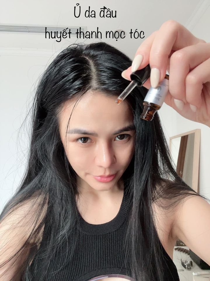 Cảm nhận của khách hàng đã dùng huyết thanh serum mọc tóc Weilaiya - myohamfrozen.vn