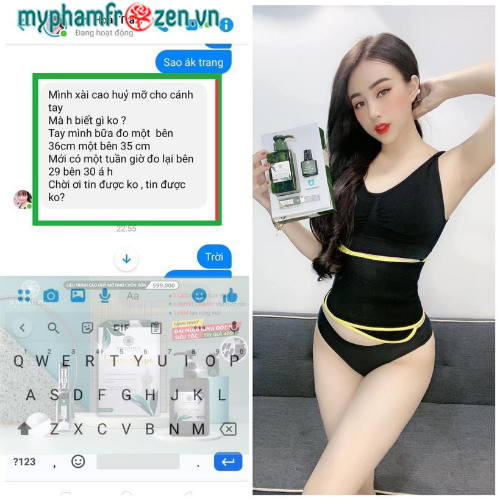 Cao hủy mỡ nhỏ cuống rốn Supper Shape