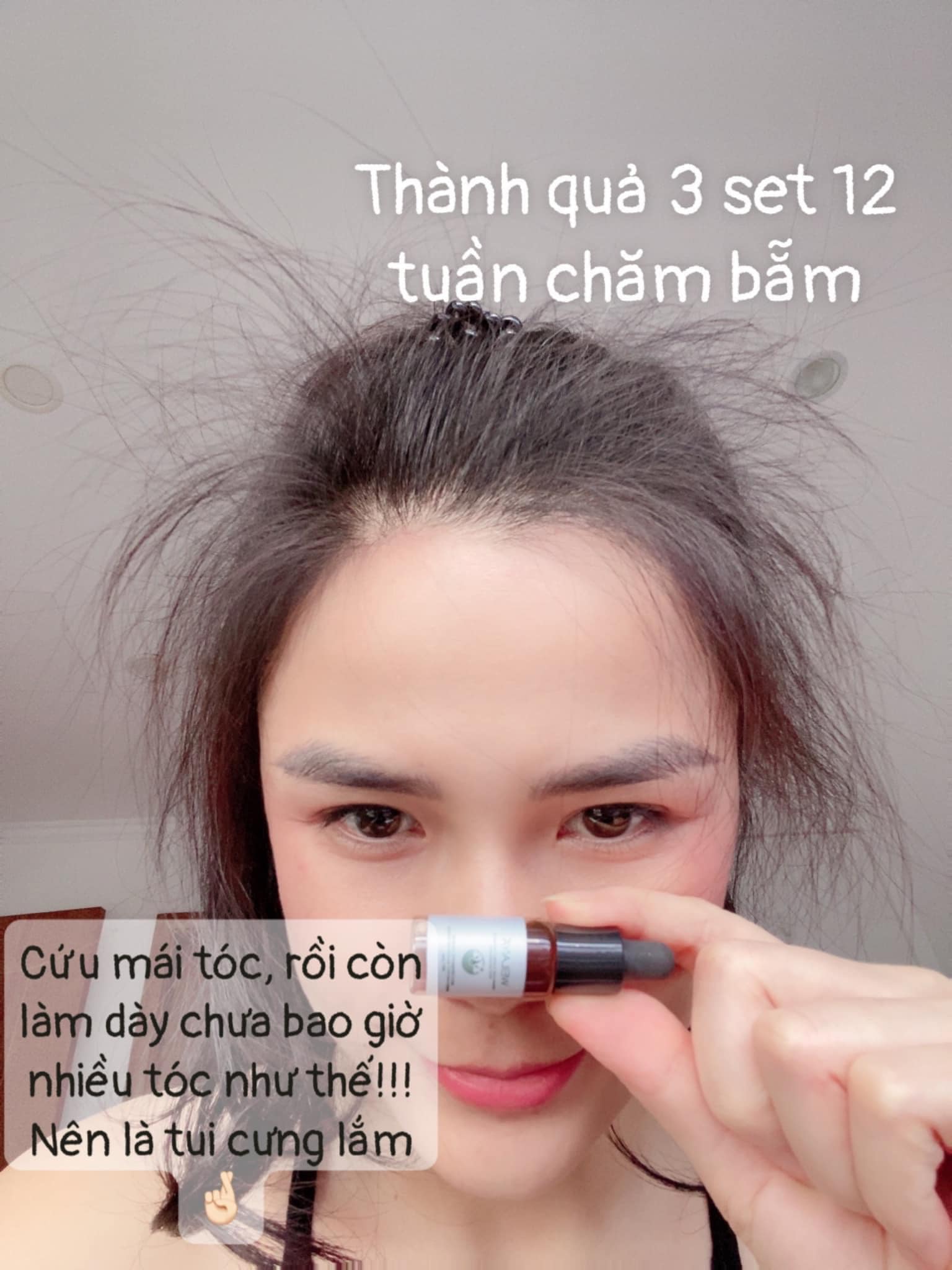 Serum kích mọc tóc Weilaiya - myphamfrozen.vn